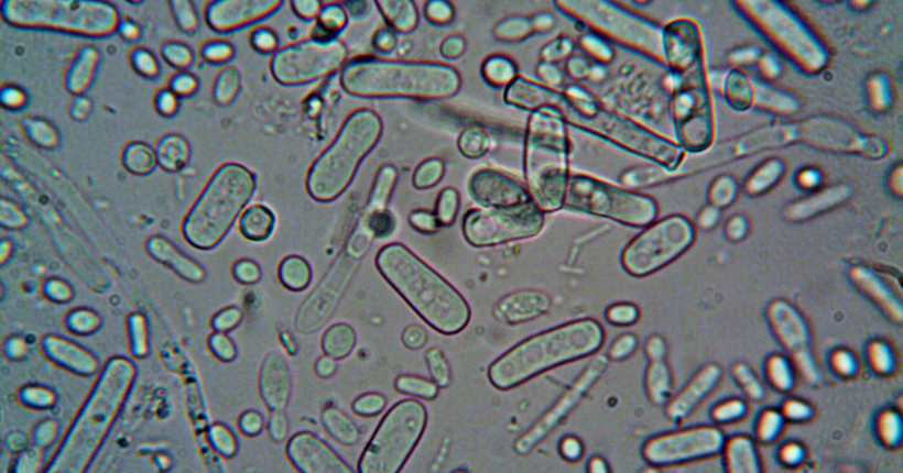 Microbiota intestinal y biomarcadores en demencia: una revisión narrativa de la literatura
