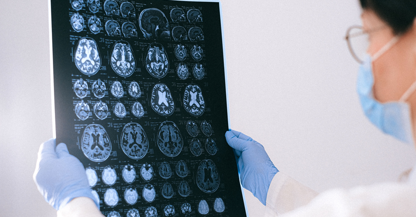 La investigación en las demencias y los trastornos neurocognitivos mayores: pasado, presente y futuro
